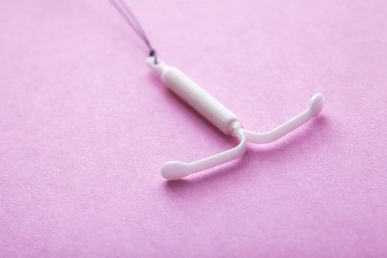 Hormonal IUD